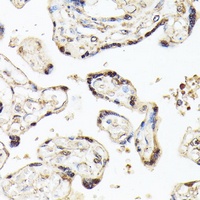 BTEB2 Rabbit Polyclonal Antibody