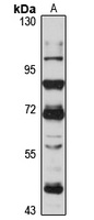 KLHL1 Antibody