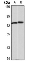 KLHL3 Rabbit Polyclonal Antibody