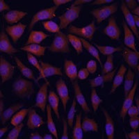 Anti-KLHL8 Antibody