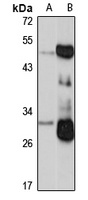 KLK2 Antibody