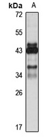Kallikrein 5 Rabbit Polyclonal Antibody