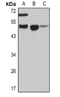 CD161 Rabbit Polyclonal Antibody