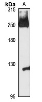 KNTC1 Antibody