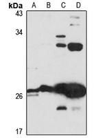 KRBOX4 Antibody