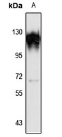 KRI1 Rabbit Polyclonal Antibody