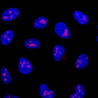 Anti-KRR1 Antibody