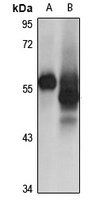 Cytokeratin 12 Rabbit Polyclonal Antibody