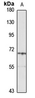 Cytokeratin 3 Rabbit Polyclonal Antibody
