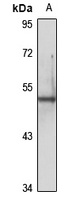 Cytokeratin 6A Rabbit Polyclonal Antibody