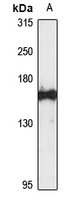 La-Related Protein 1 Rabbit Polyclonal Antibody