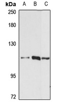 LARP2 Antibody