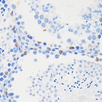 Anti-LARP2 Antibody