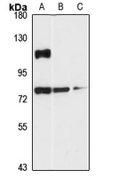 LARP4B Antibody
