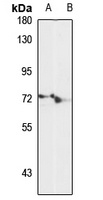 LARP7 Rabbit Polyclonal Antibody