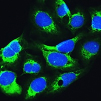 Anti-LARS Antibody