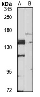 LATS2 Rabbit Polyclonal Antibody