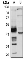CLIM-1 Rabbit Polyclonal Antibody