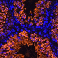 Anti-LDHC Antibody