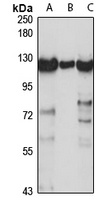 LDL Receptor Rabbit Polyclonal Antibody