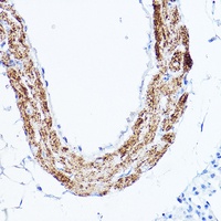 LDL Receptor Rabbit Polyclonal Antibody