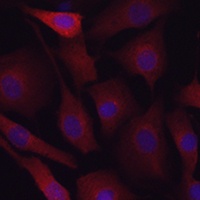 LDL Receptor Rabbit Polyclonal Antibody