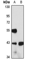 TCF1 alpha Rabbit Polyclonal Antibody