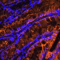 Anti-Galectin 4 Antibody