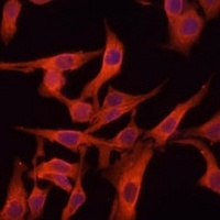 Anti-Legumain Antibody