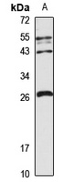 LHFPL2 Rabbit Polyclonal Antibody