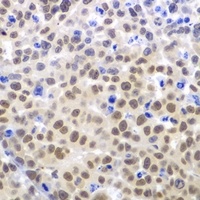 Anti-LHX4 Antibody