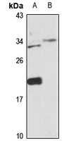 LIME Rabbit Polyclonal Antibody