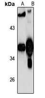 LIMS2 Antibody