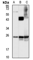 Veli-3 Rabbit Polyclonal Antibody