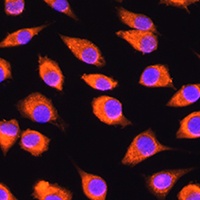 Anti-LMBRD1 Antibody