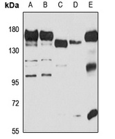 P-LAP Rabbit Polyclonal Antibody