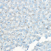 P-LAP Rabbit Polyclonal Antibody