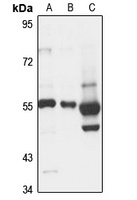 LPAAT eta Rabbit Polyclonal Antibody
