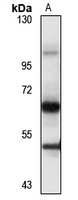 LPL Rabbit Polyclonal Antibody