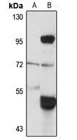 Jaw1 Rabbit Polyclonal Antibody