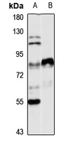 Lactoferrin Rabbit Polyclonal Antibody