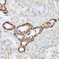 Lactoferrin Rabbit Polyclonal Antibody