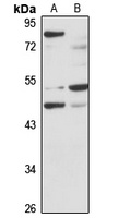 MAGEA11 Rabbit Polyclonal Antibody