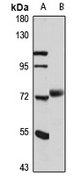 MAK Rabbit Polyclonal Antibody