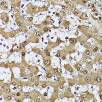 Anti-MAK Antibody