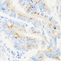 MAN1A2 antibody