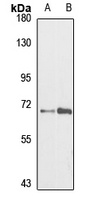 MAN1C1 Rabbit Polyclonal Antibody