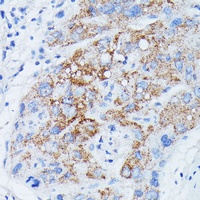 Anti-MANBA Antibody