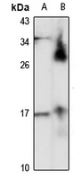 LC3C Rabbit Polyclonal Antibody