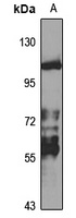 DLK Rabbit Polyclonal Antibody